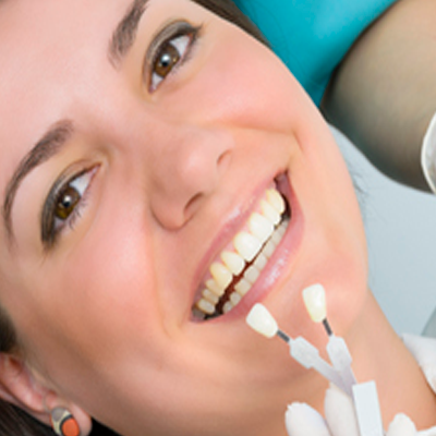 Estética Dental